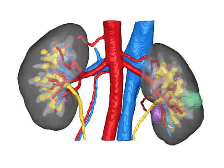 Kidney model from innersight