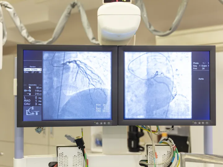 View of modern medical X-ray operating room (cath lab)
