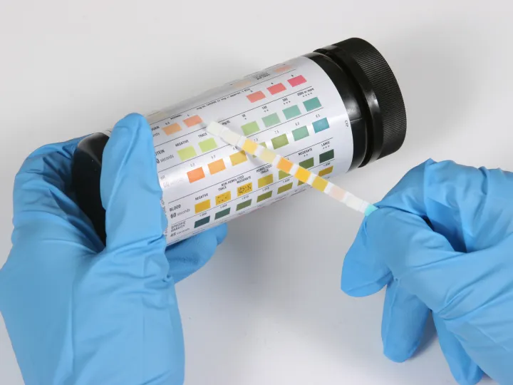 Urine dipstick being read by a medical professional