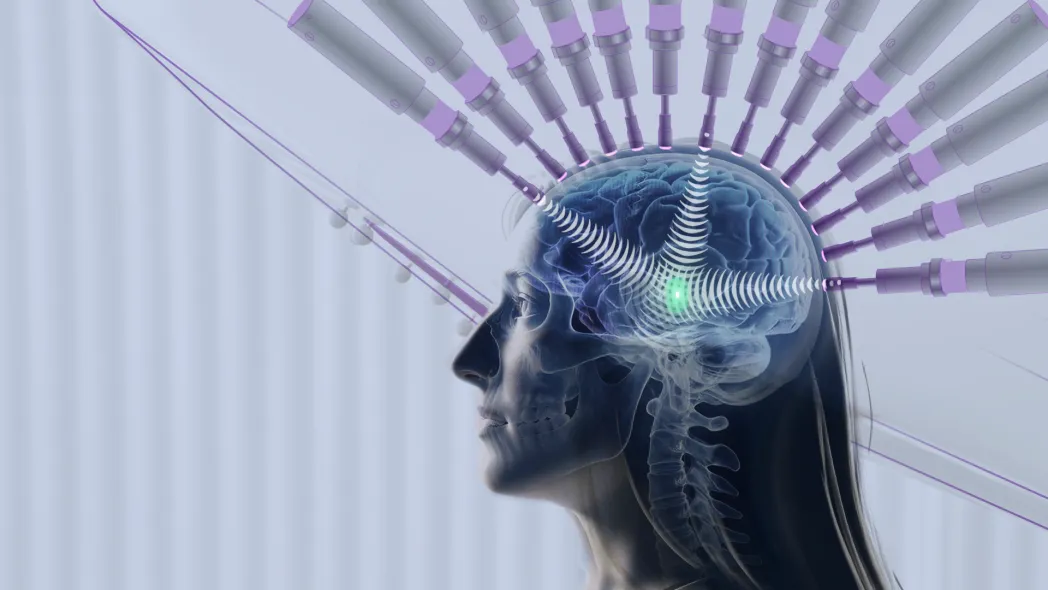 Ultrasounds directed to specific part of the brain overlaid onto a photo of a woman
