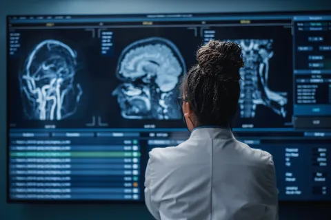 female clinician looking at brain scans