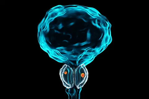 malignant tumor compresses urethra