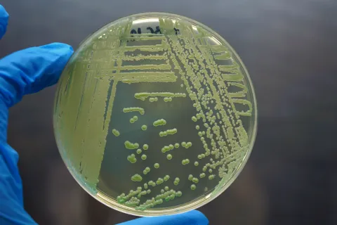 petri dish with yeast culture