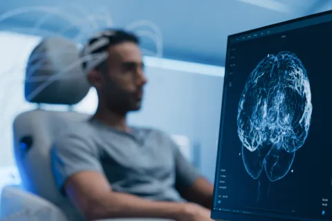Medical Brain Scan on Computer Screen