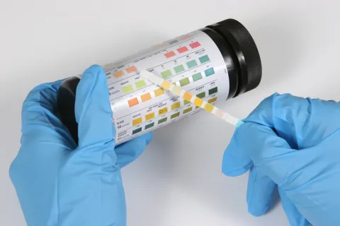 Urine dipstick being read by a medical professional