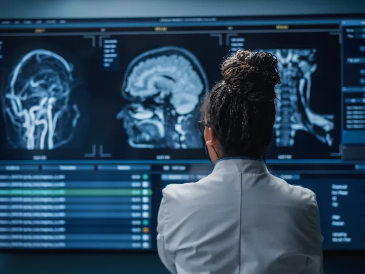 female clinician looking at brain scans