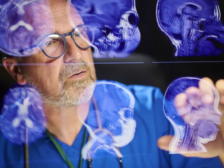 Surgeon analysing brain scans 
