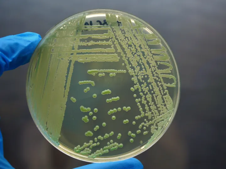 petri dish with yeast culture