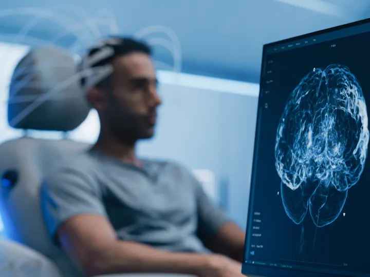 Medical Brain Scan on Computer Screen